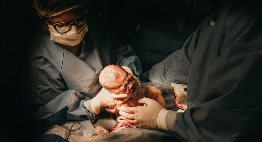 woman giving birth via c-section