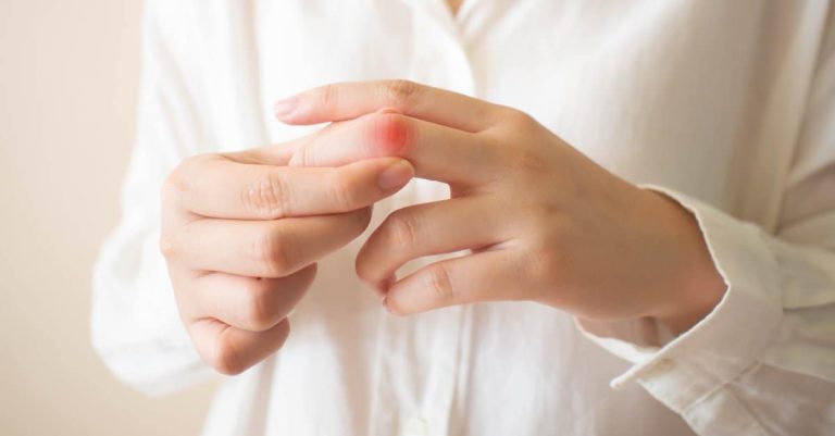 6 Spiritual Meanings When You Dream About Broken Fingers